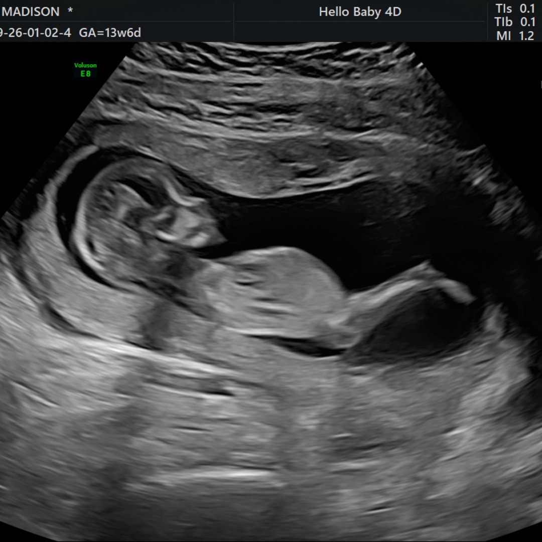 Photo shared by Madi for their Babylist baby registry.