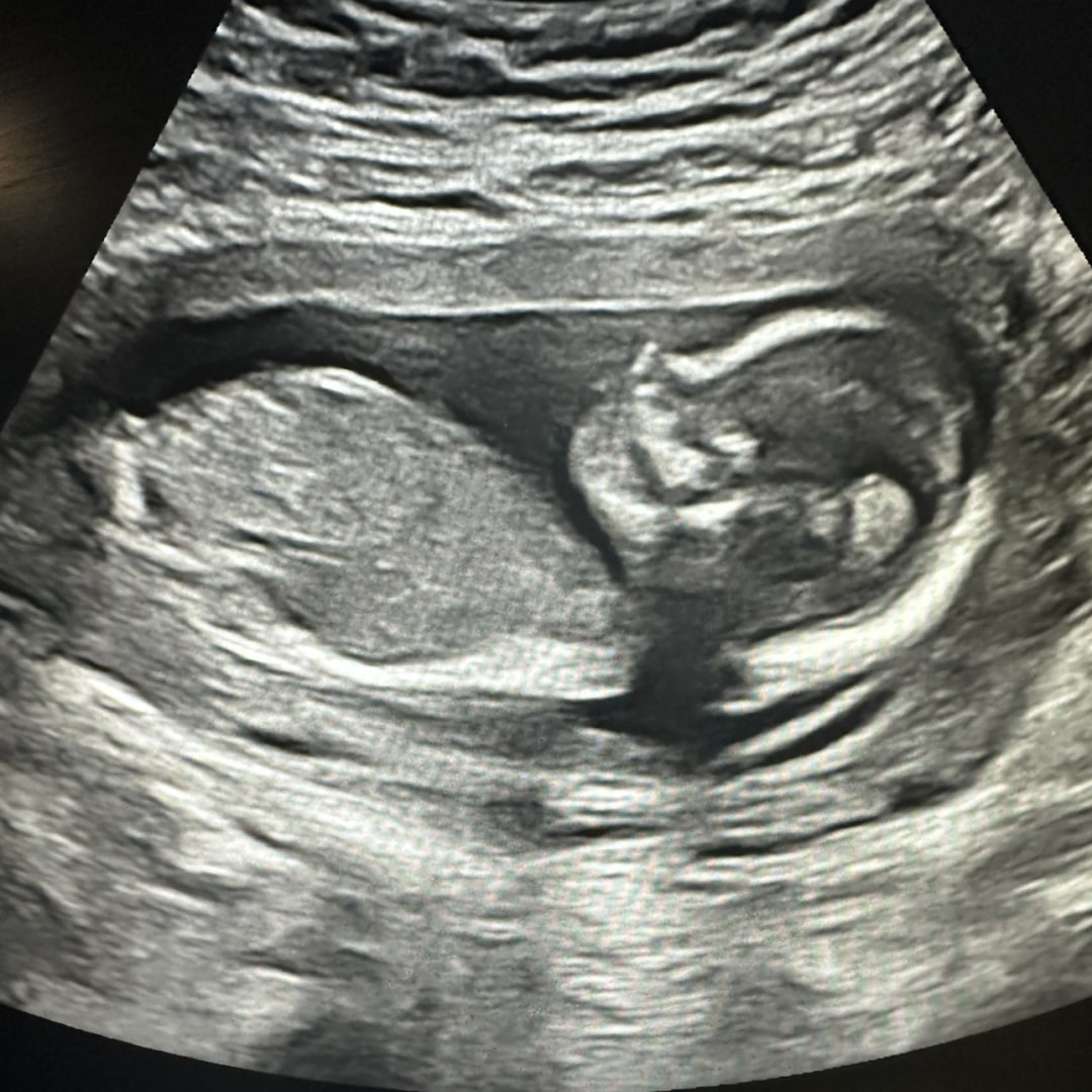 Photo shared by Cheyenne for their Babylist baby registry.