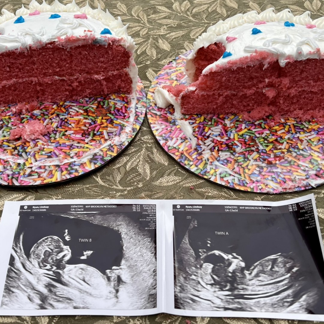 Photo shared by Lindsay for their Babylist baby registry.