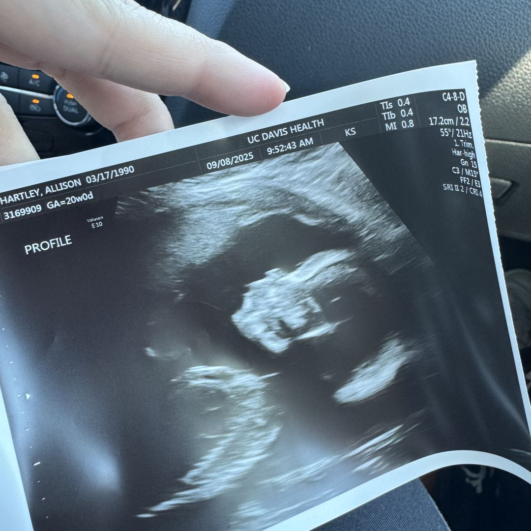 Photo shared by Allison for their Babylist baby registry.