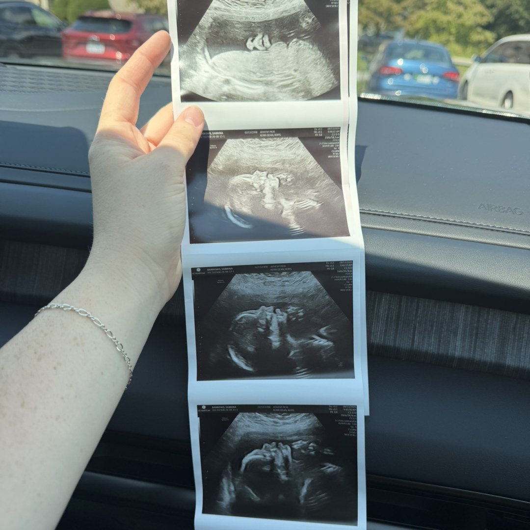 Photo shared by Sabrina for their Babylist baby registry.