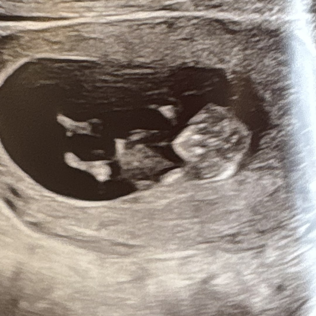 Photo shared by Peyton for their Babylist baby registry.