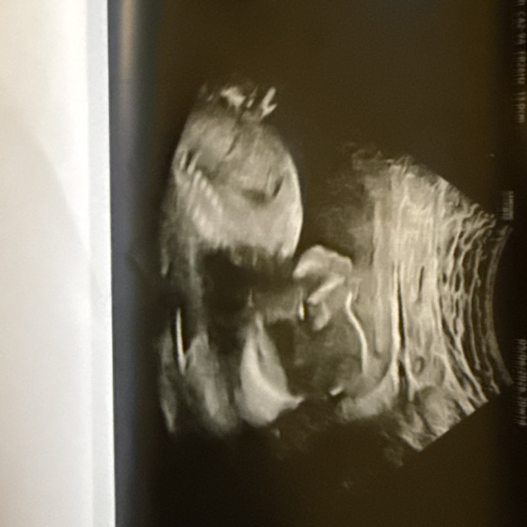 Photo shared by Leilani for their Babylist baby registry.