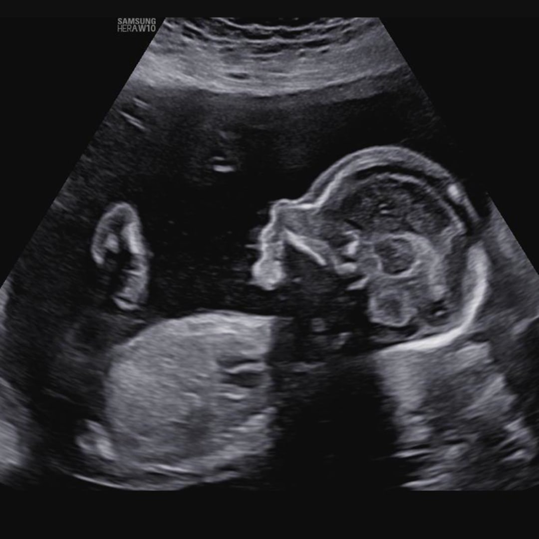 Photo shared by Erica for their Babylist baby registry.