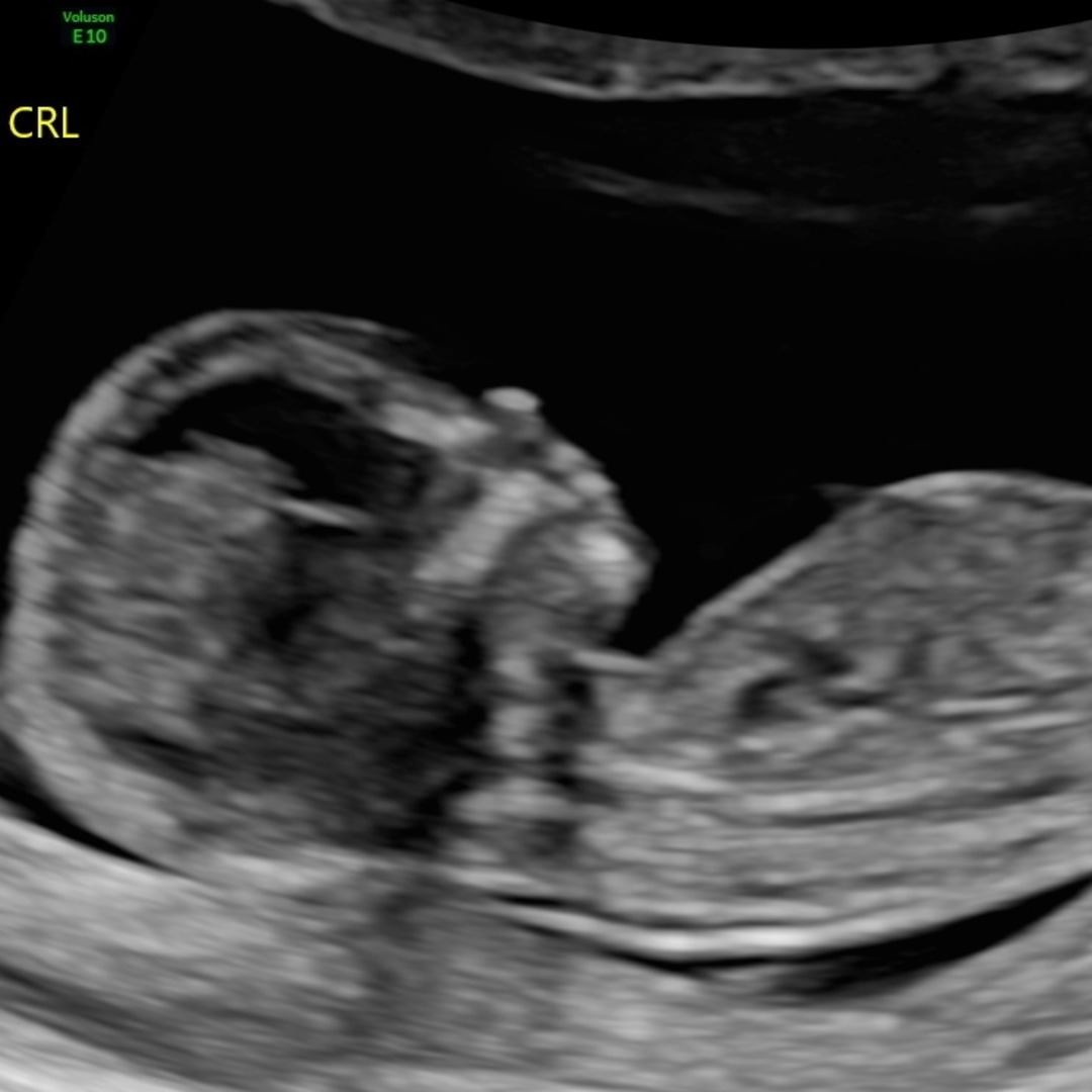 Photo shared by Alix for their Babylist baby registry.