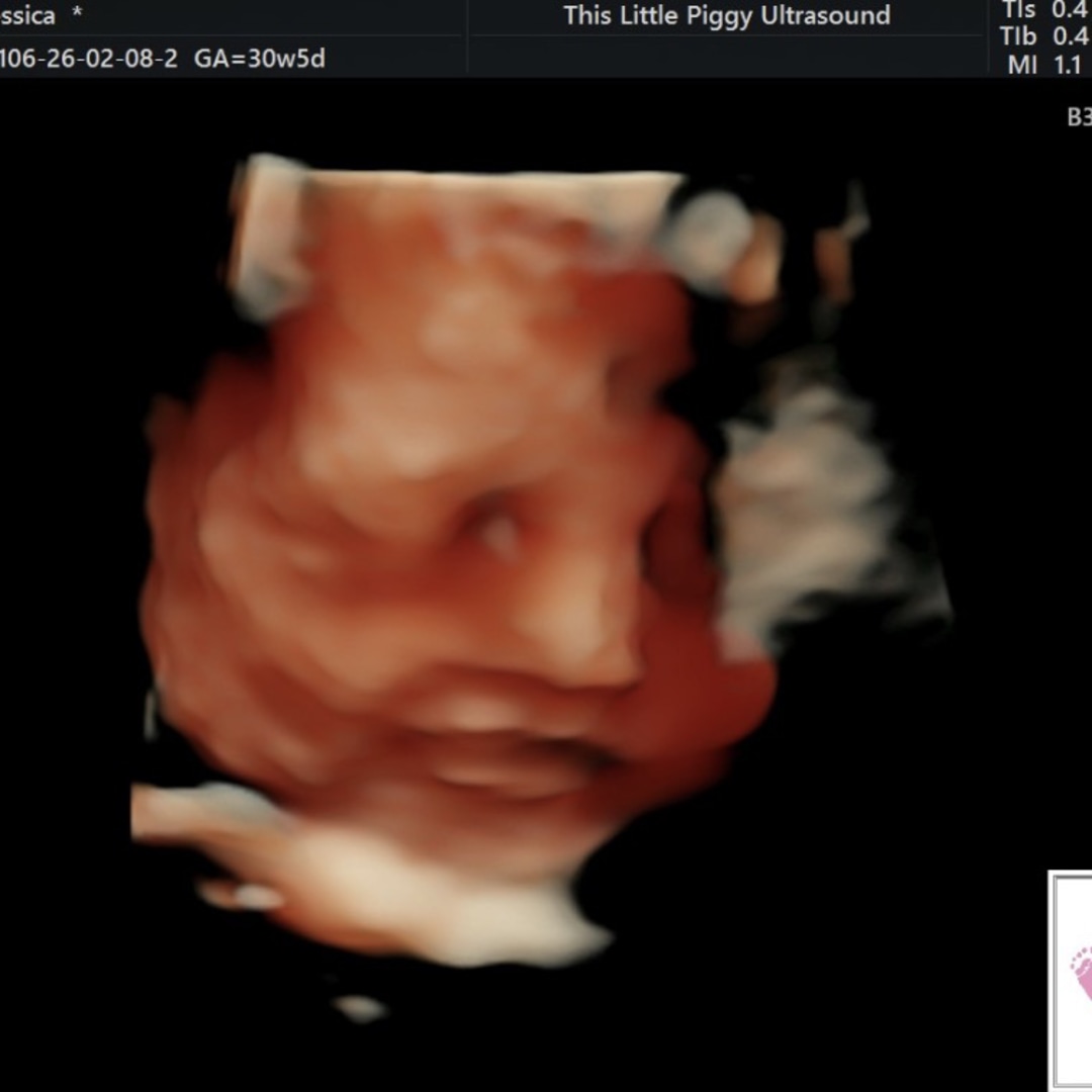 Photo shared by Jessica for their Babylist baby registry.