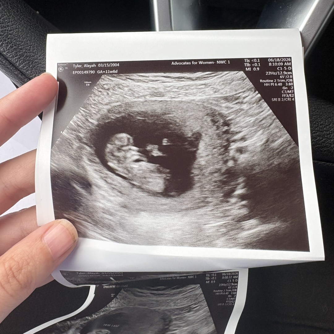 Photo shared by Alayah for their Babylist baby registry.