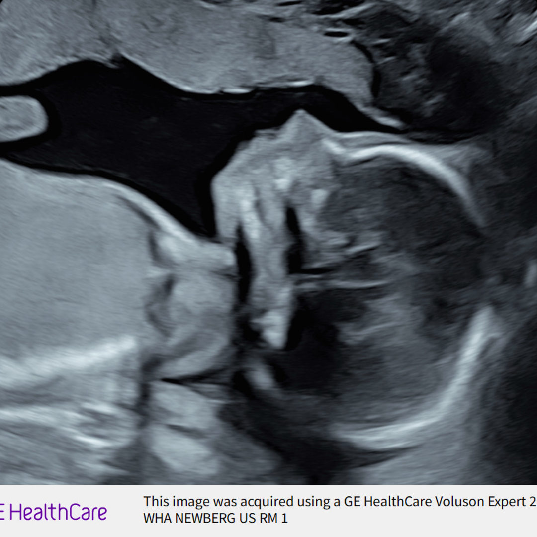 Photo shared by Brianna for their Babylist baby registry.