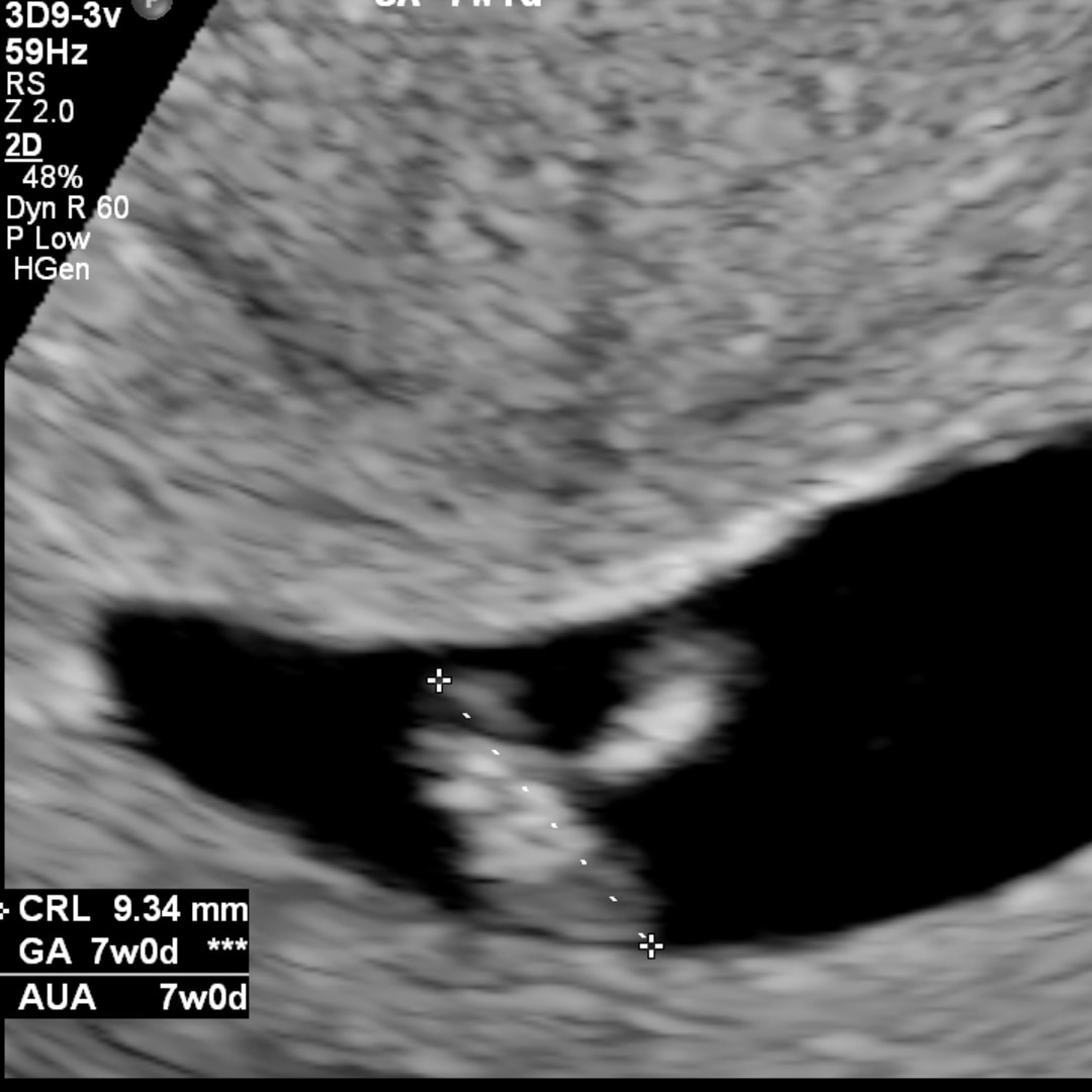 Photo shared by Darcie for their Babylist baby registry.