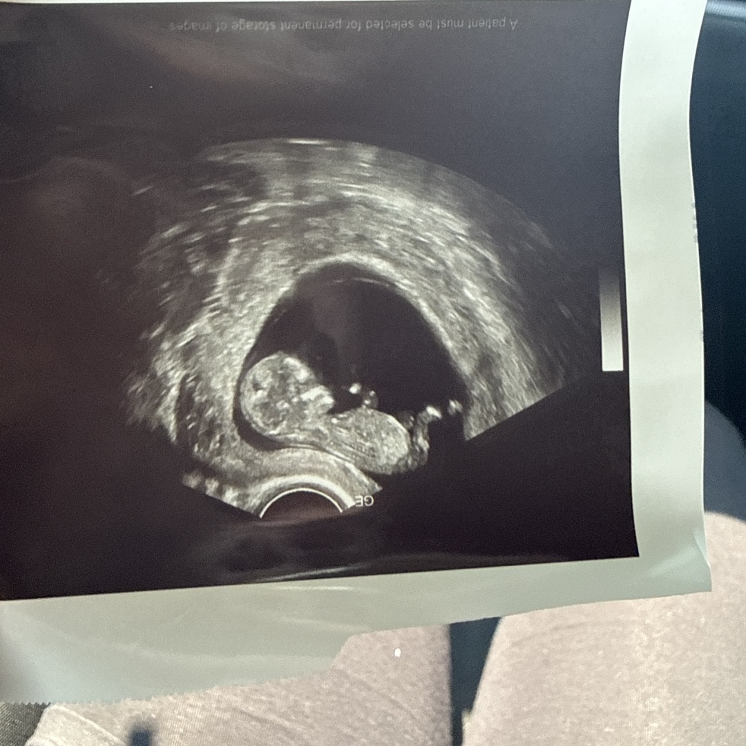 Photo shared by Brenda for their Babylist baby registry.