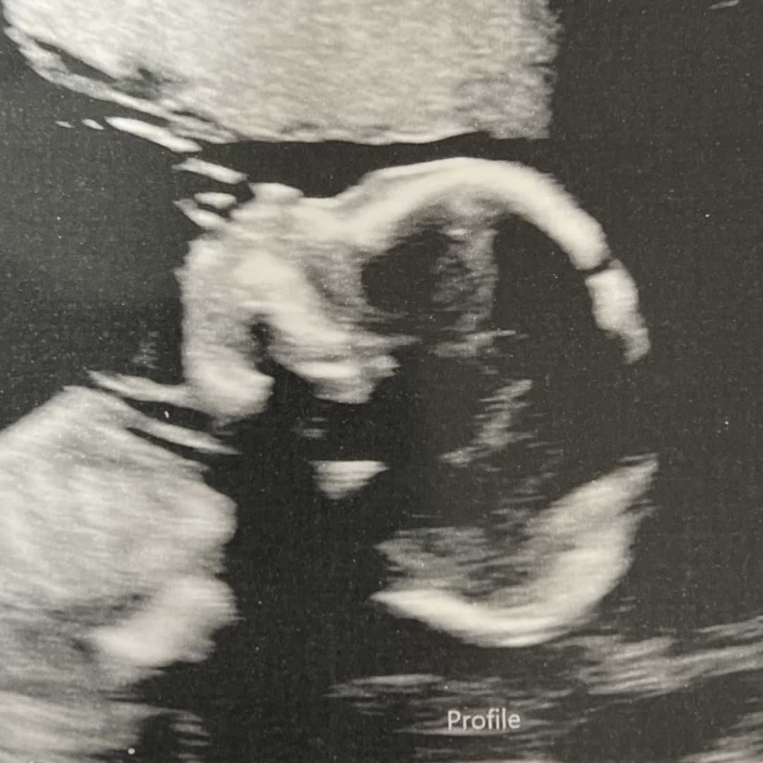Photo shared by Israel for their Babylist baby registry.