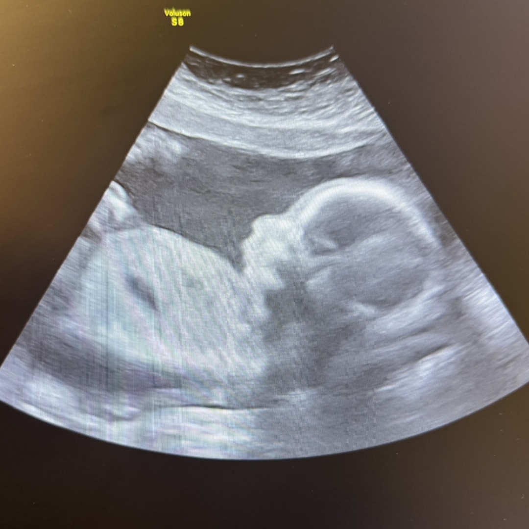 Photo shared by Kaelynn for their Babylist baby registry.