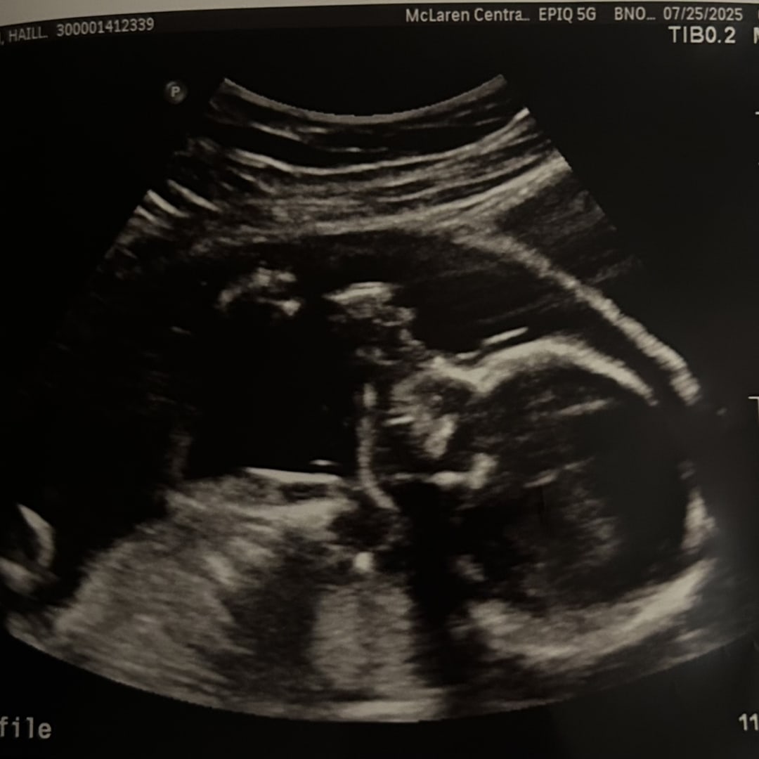 Photo shared by Hailey for their Babylist baby registry.