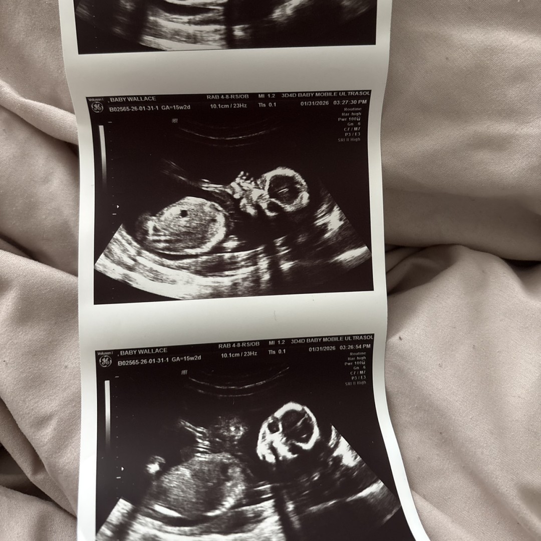 Photo shared by Sydney for their Babylist baby registry.