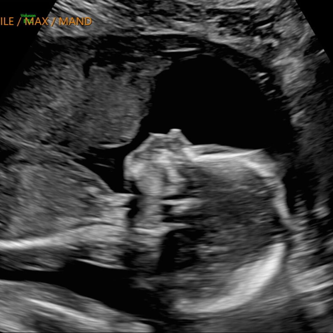 Photo shared by Emily for their Babylist baby registry.