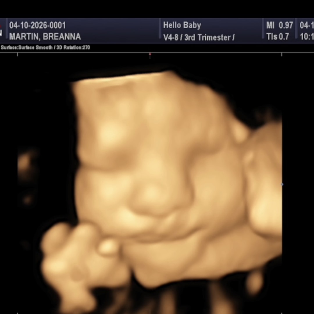 Photo shared by Breanna for their Babylist baby registry.