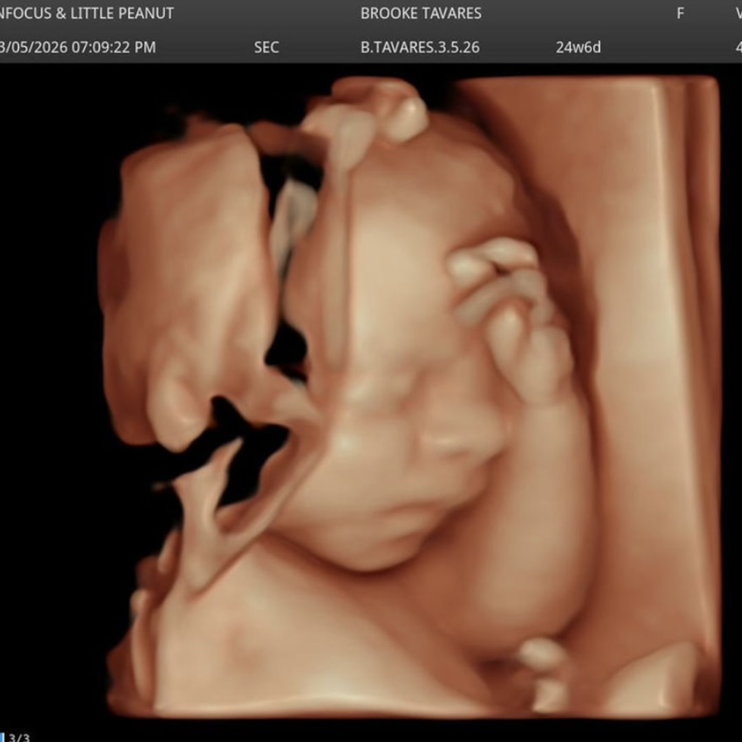 Photo shared by Brooke for their Babylist baby registry.