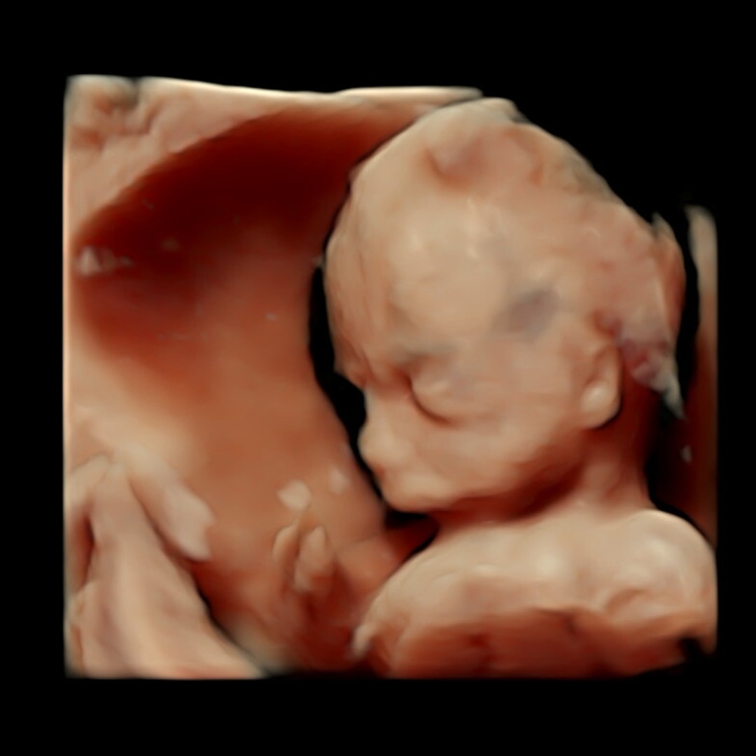 Photo shared by Chana for their Babylist baby registry.