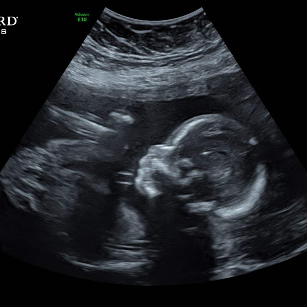 Photo shared by Courtney for their Babylist baby registry.