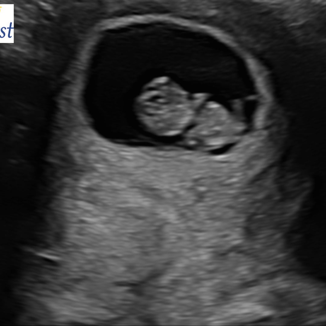 Photo shared by Katie for their Babylist baby registry.