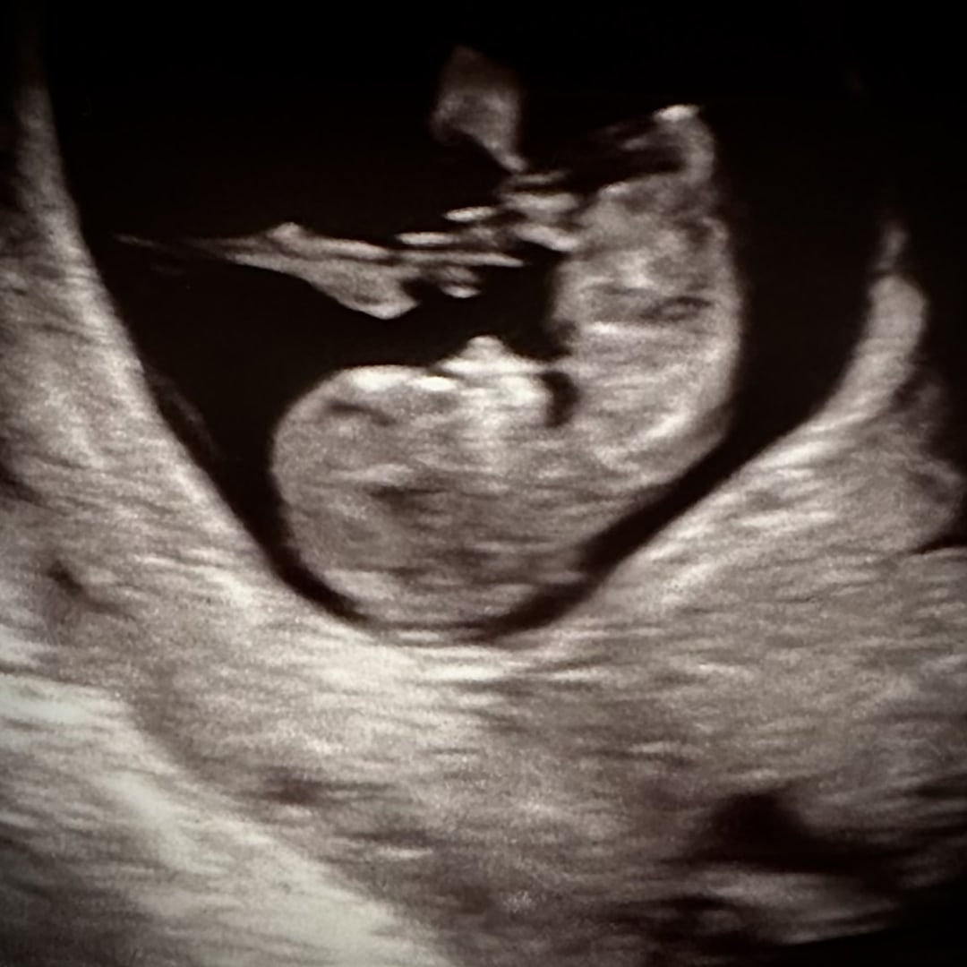 Photo shared by Amanda for their Babylist baby registry.