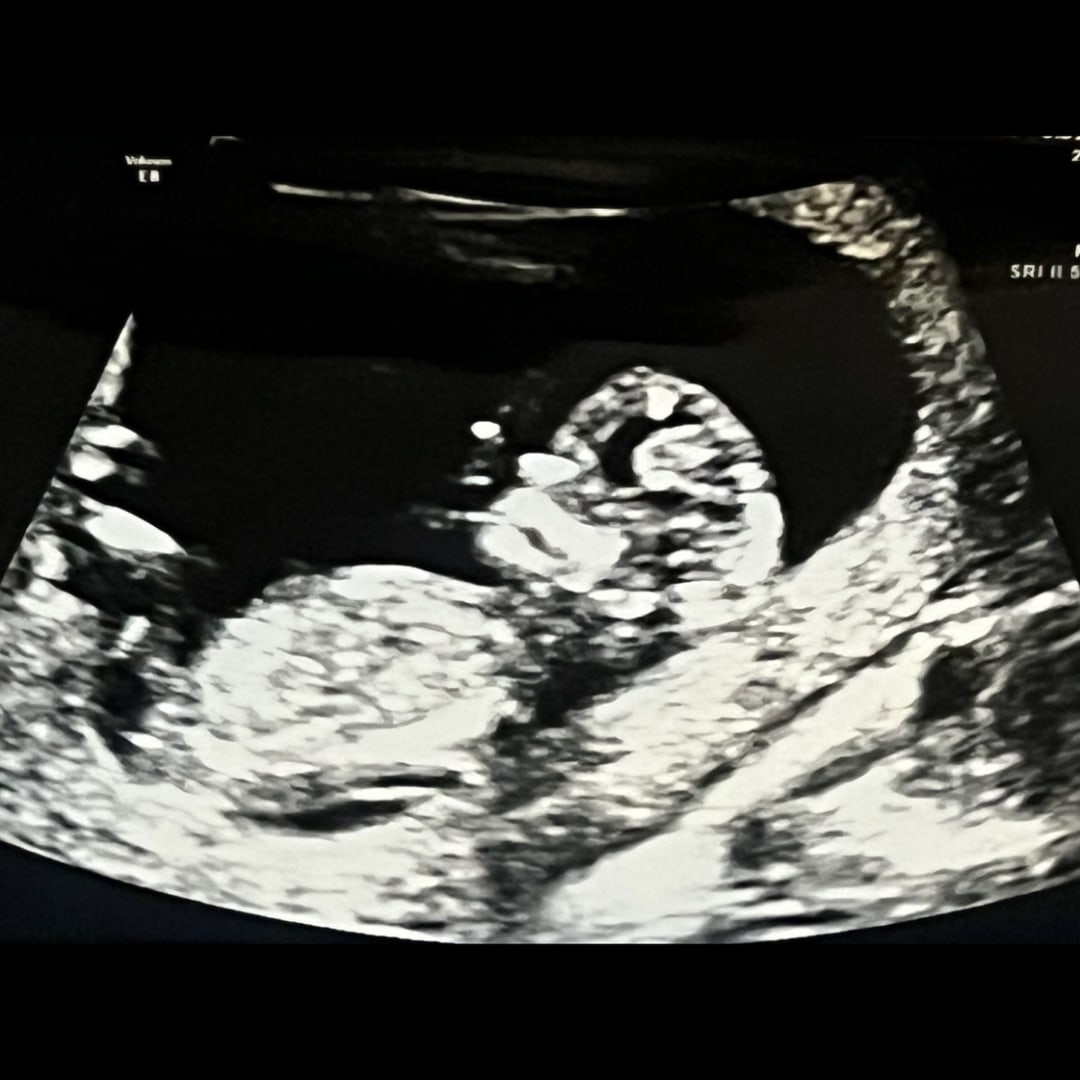 Photo shared by Anya for their Babylist baby registry.