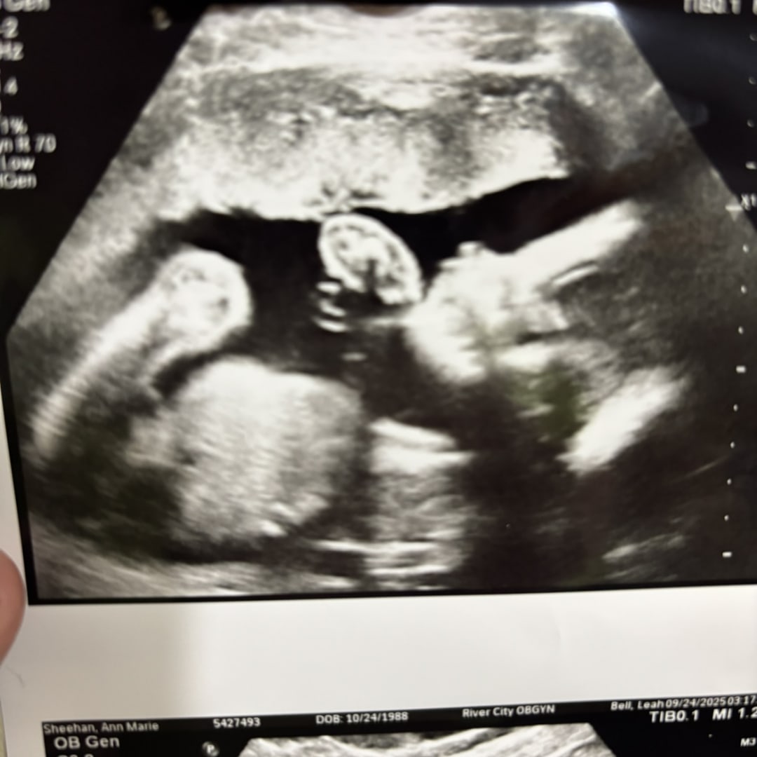 Photo shared by Ann-Marie for their Babylist baby registry.