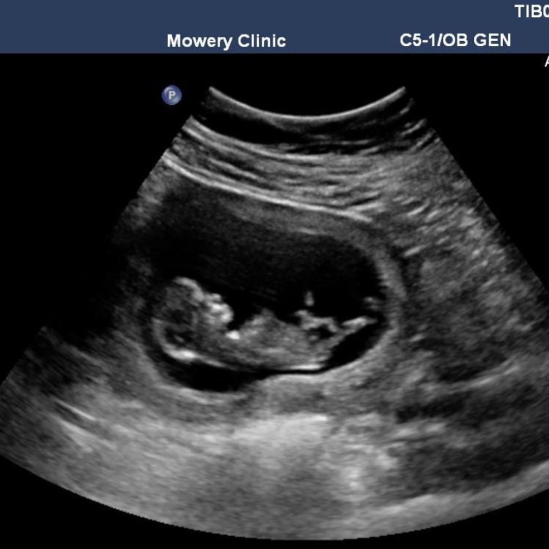 Photo shared by Krista for their Babylist baby registry.