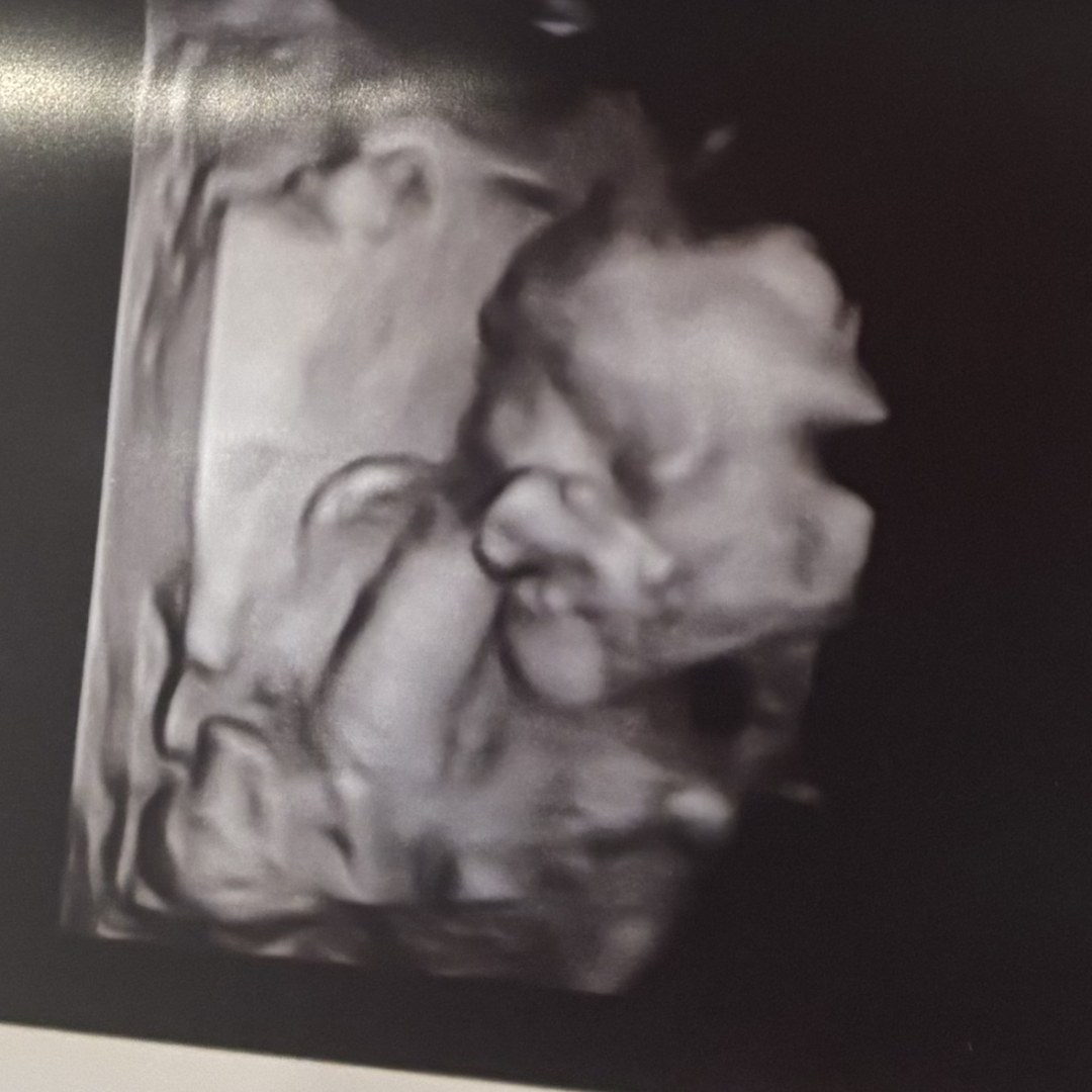 Photo shared by Erin for their Babylist baby registry.