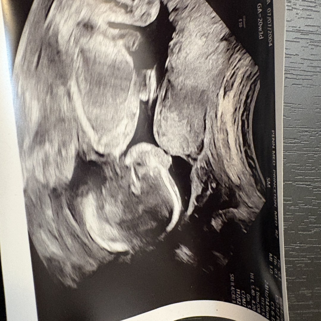 Photo shared by Alyssa for their Babylist baby registry.