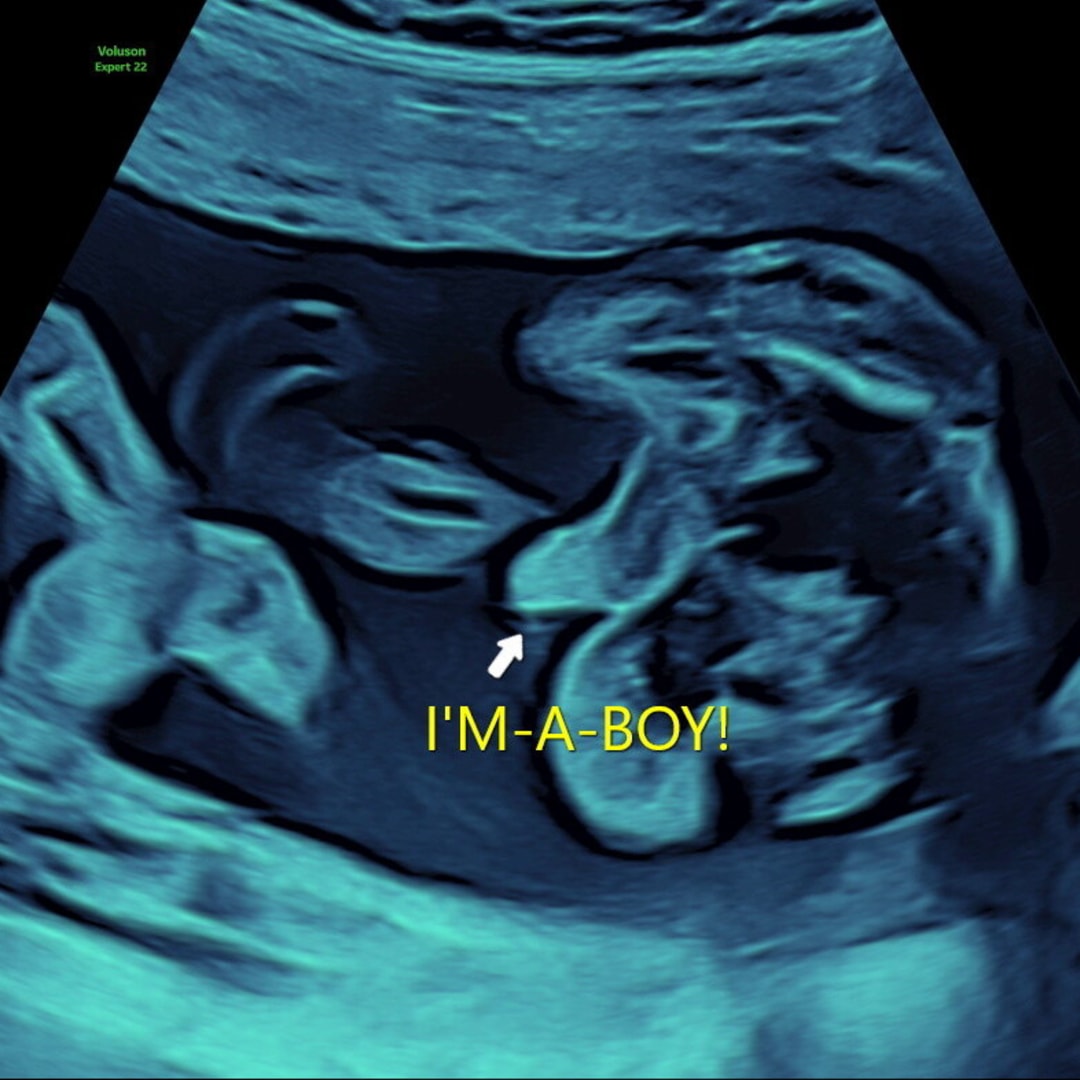 Photo shared by Brailey for their Babylist baby registry.
