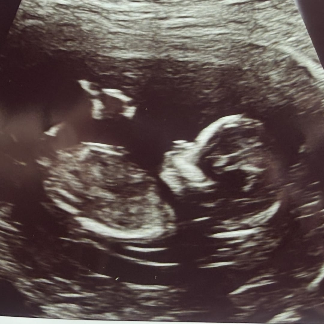 Photo shared by Sophia for their Babylist baby registry.
