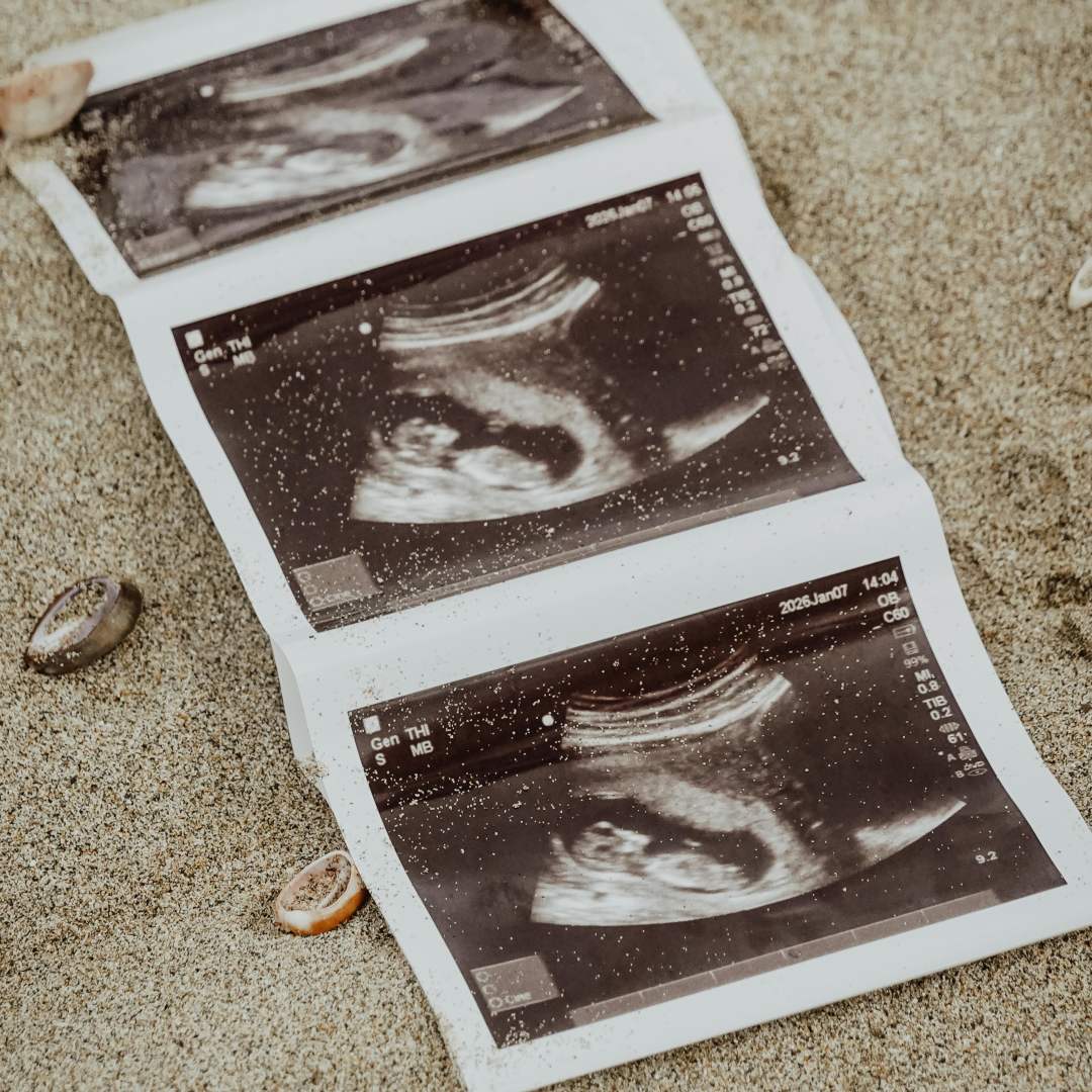 Photo shared by Taylor for their Babylist baby registry.