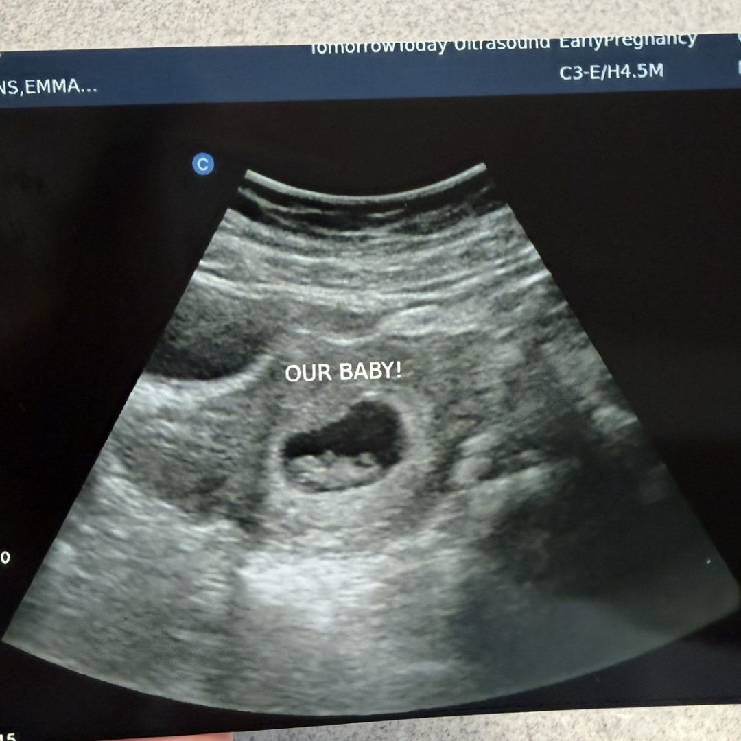 Photo shared by Emmalee for their Babylist baby registry.