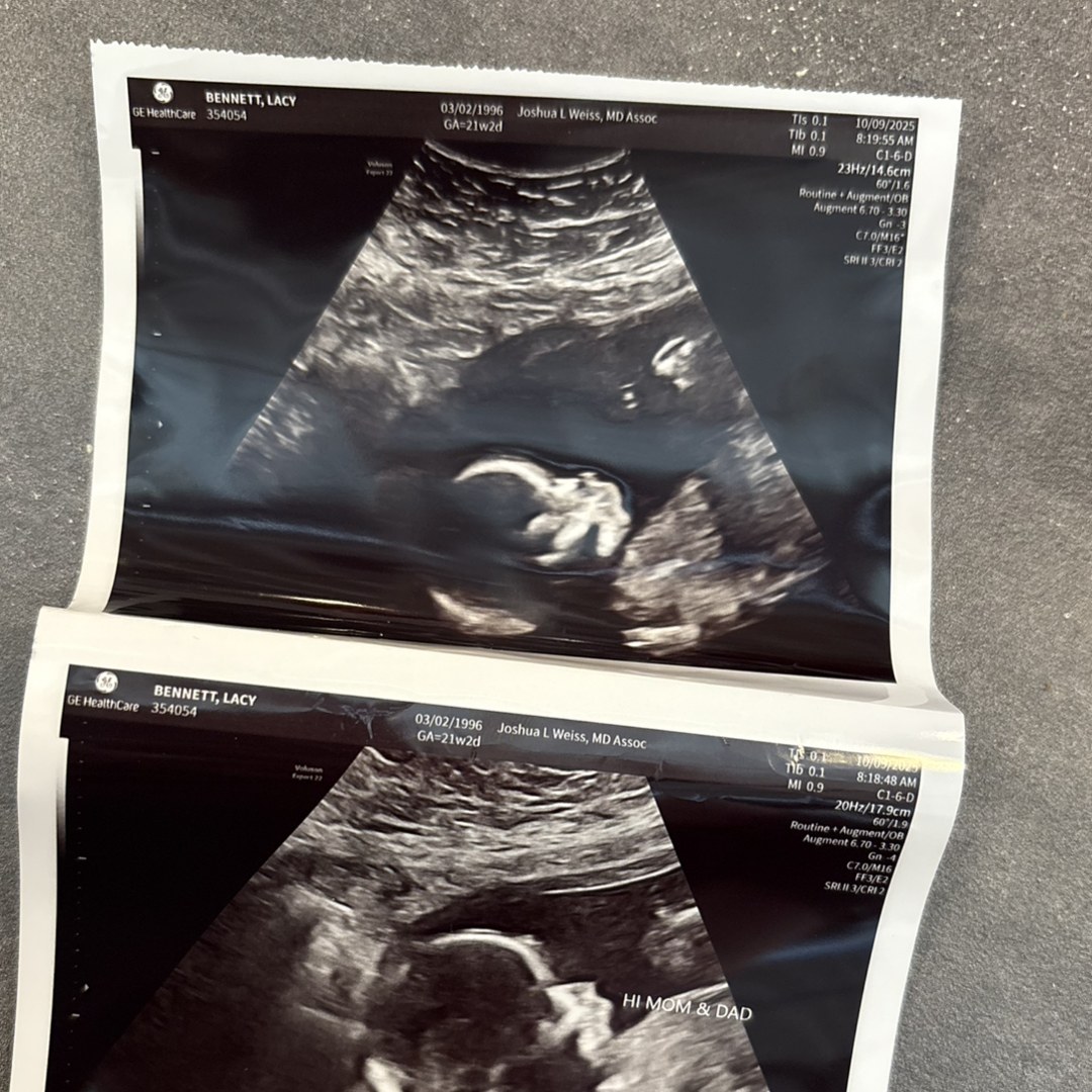 Photo shared by Lacy for their Babylist baby registry.