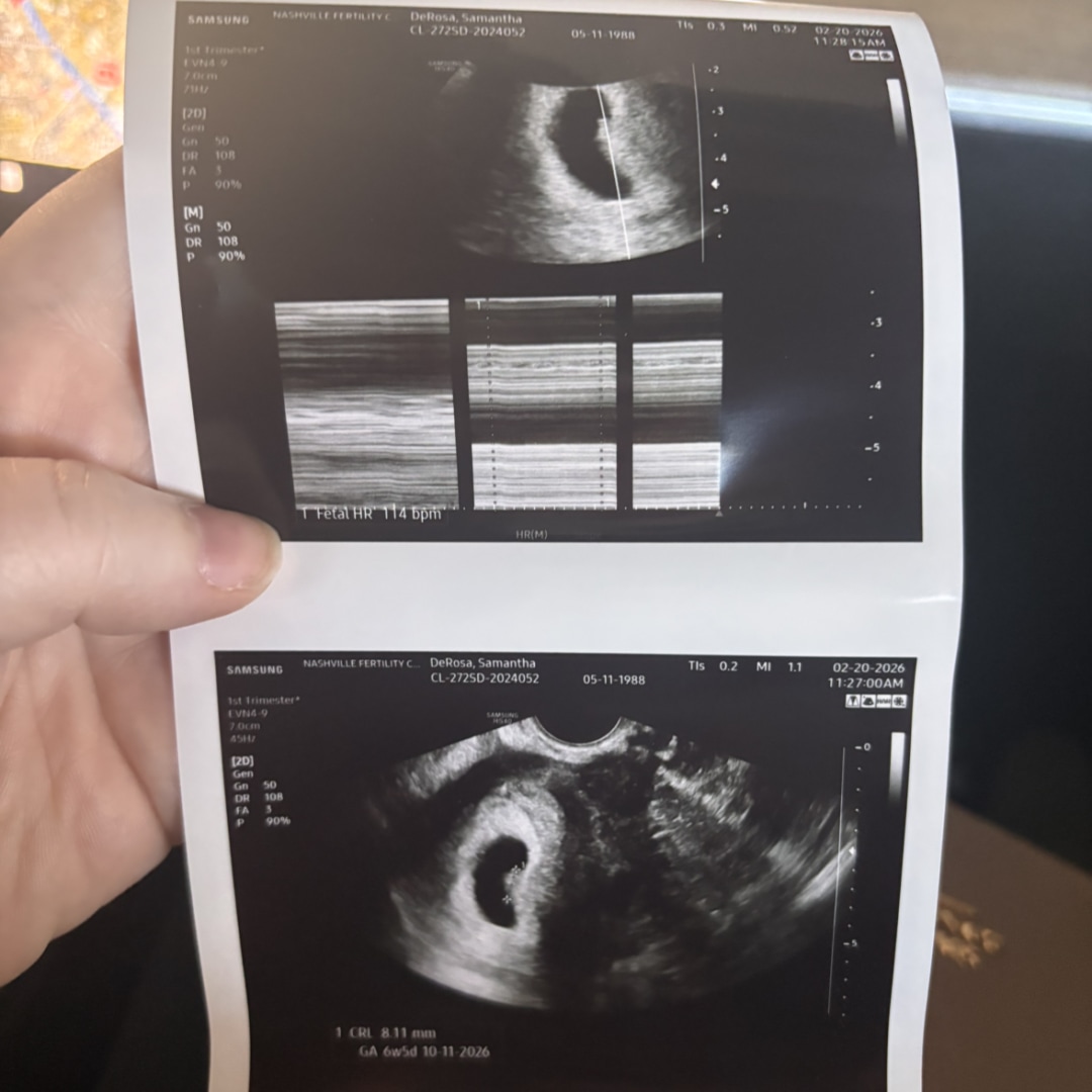 Photo shared by Samantha for their Babylist baby registry.