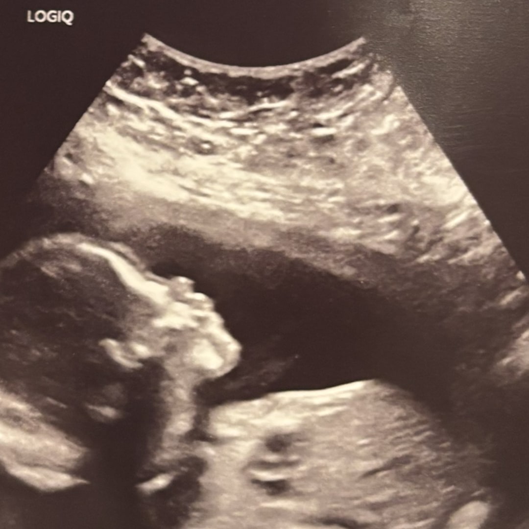 Photo shared by Isabela for their Babylist baby registry.