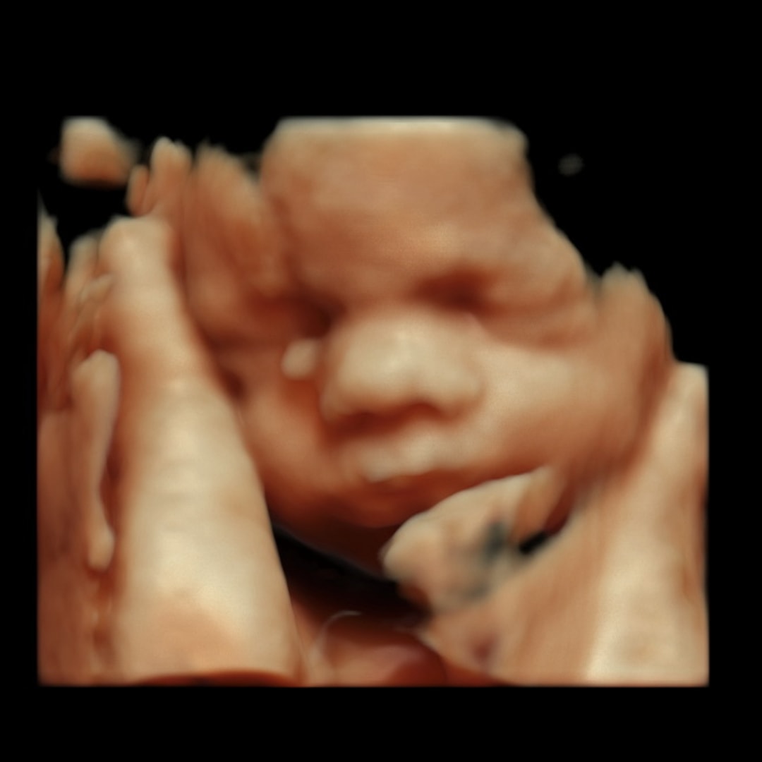 Photo shared by Rachel for their Babylist baby registry.