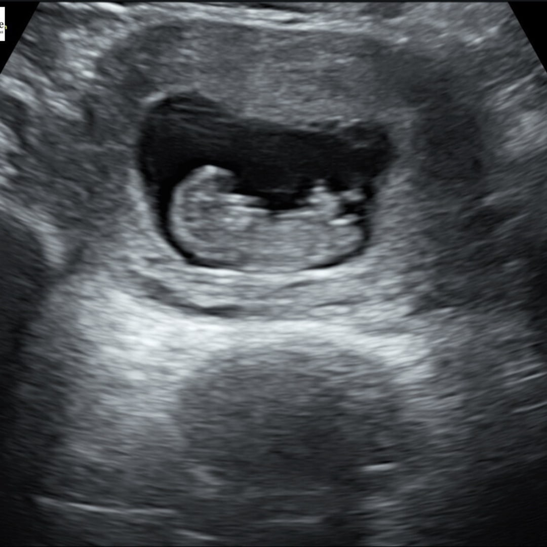 Photo shared by Jennifer for their Babylist baby registry.