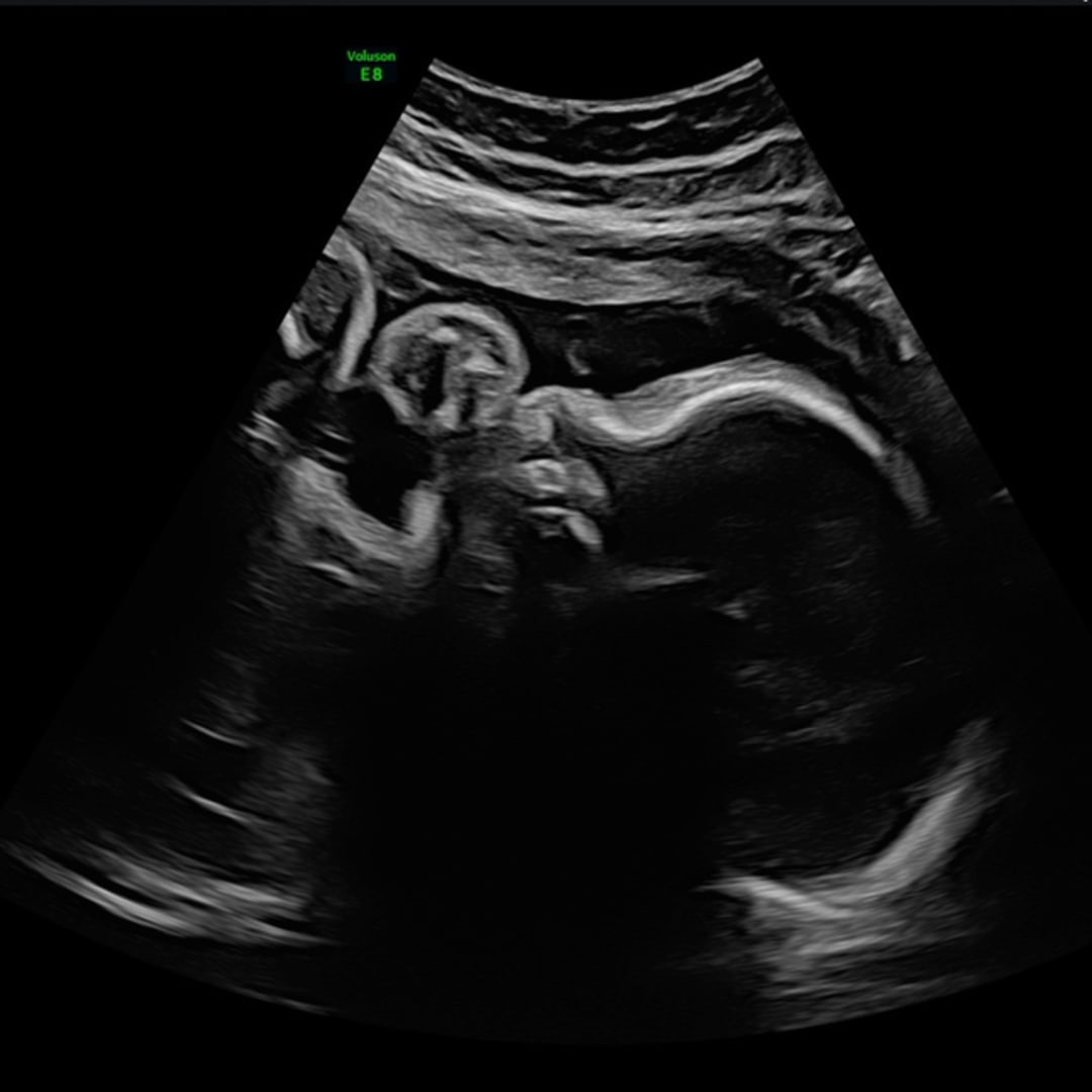 Photo shared by Helen for their Babylist baby registry.