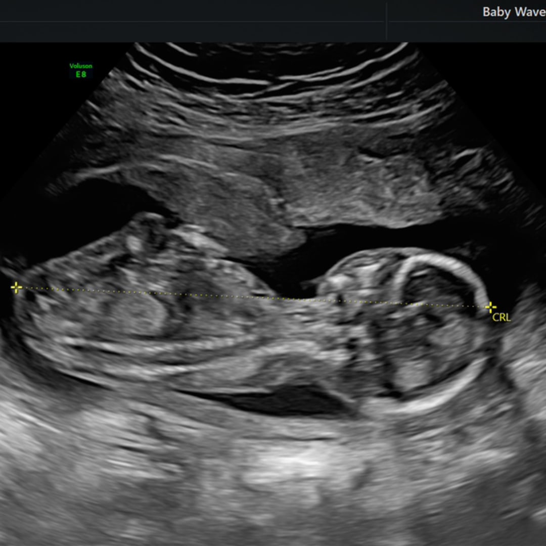 Photo shared by Isabella for their Babylist baby registry.