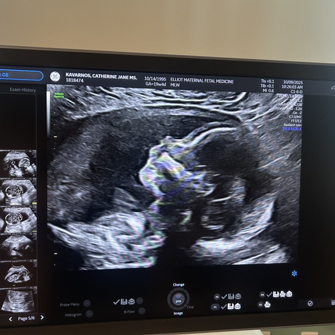 Photo shared by Catherine for their Babylist baby registry.