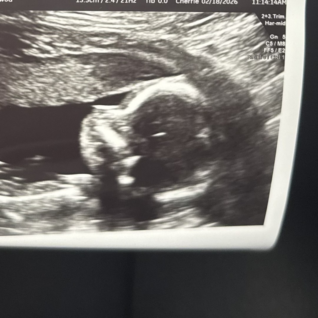 Photo shared by Brianna for their Babylist baby registry.