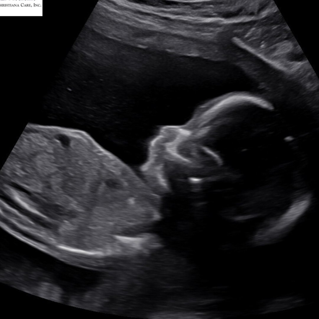 Photo shared by Renee for their Babylist baby registry.