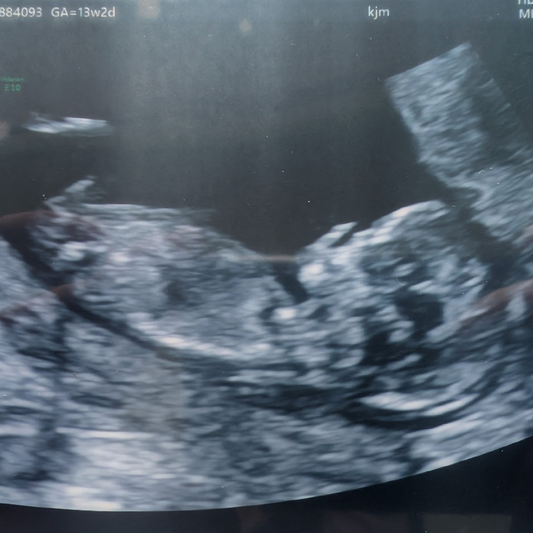 Photo shared by Marieve for their Babylist baby registry.
