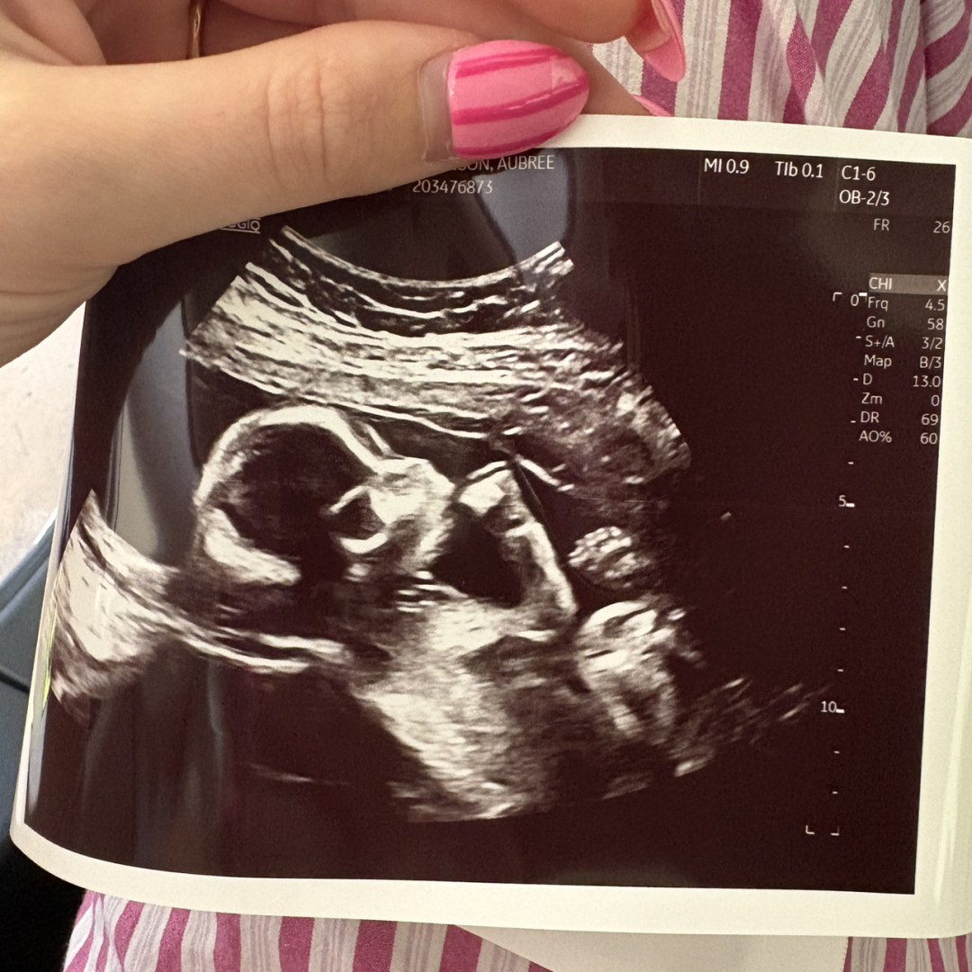 Photo shared by Lawson for their Babylist baby registry.