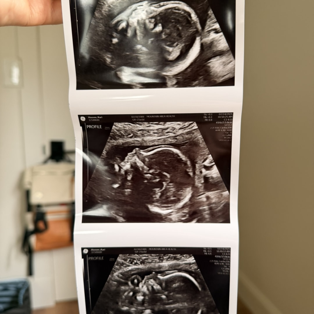 Photo shared by Kari for their Babylist baby registry.