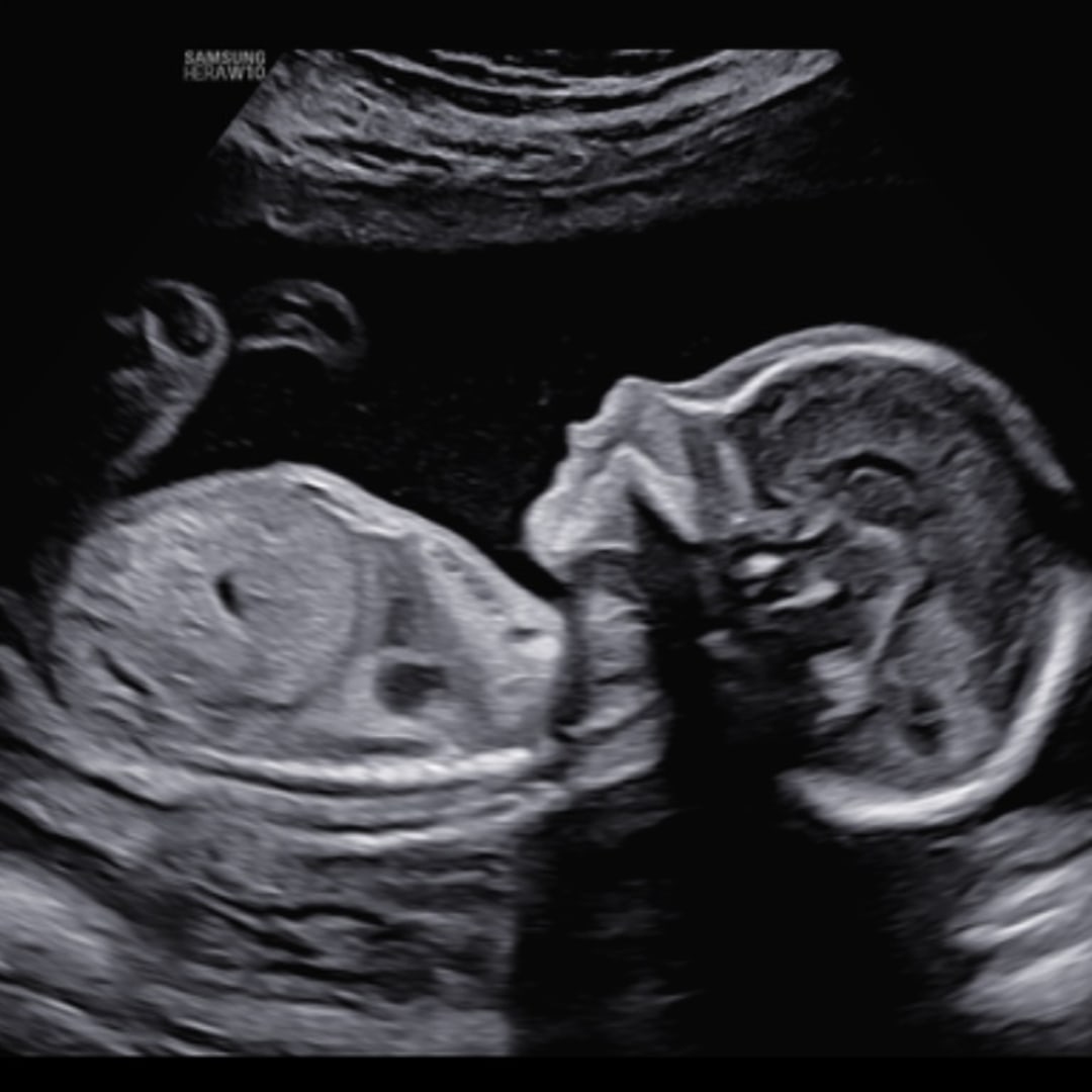 Photo shared by Franzi for their Babylist baby registry.