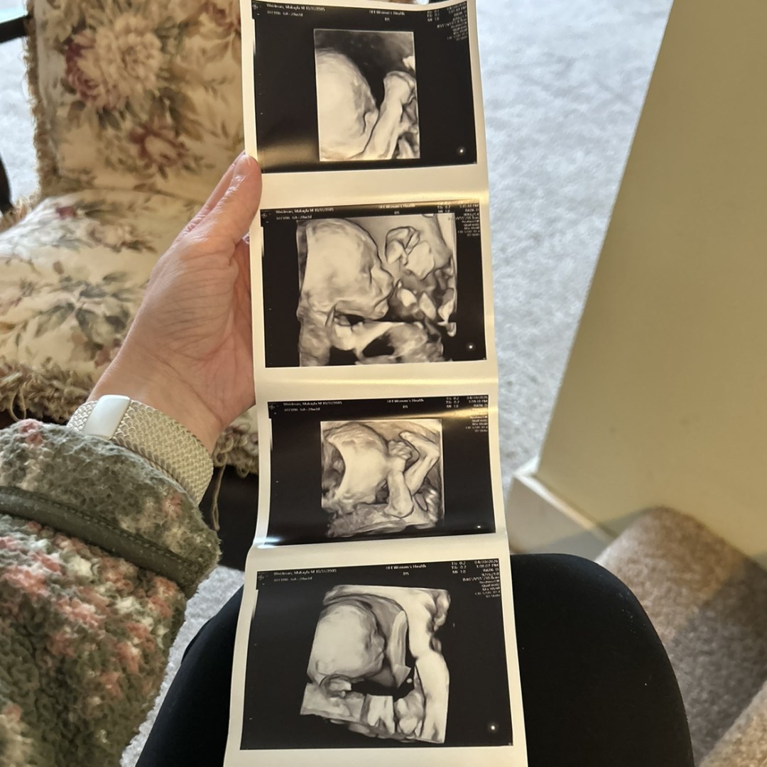 Photo shared by Makayla for their Babylist baby registry.