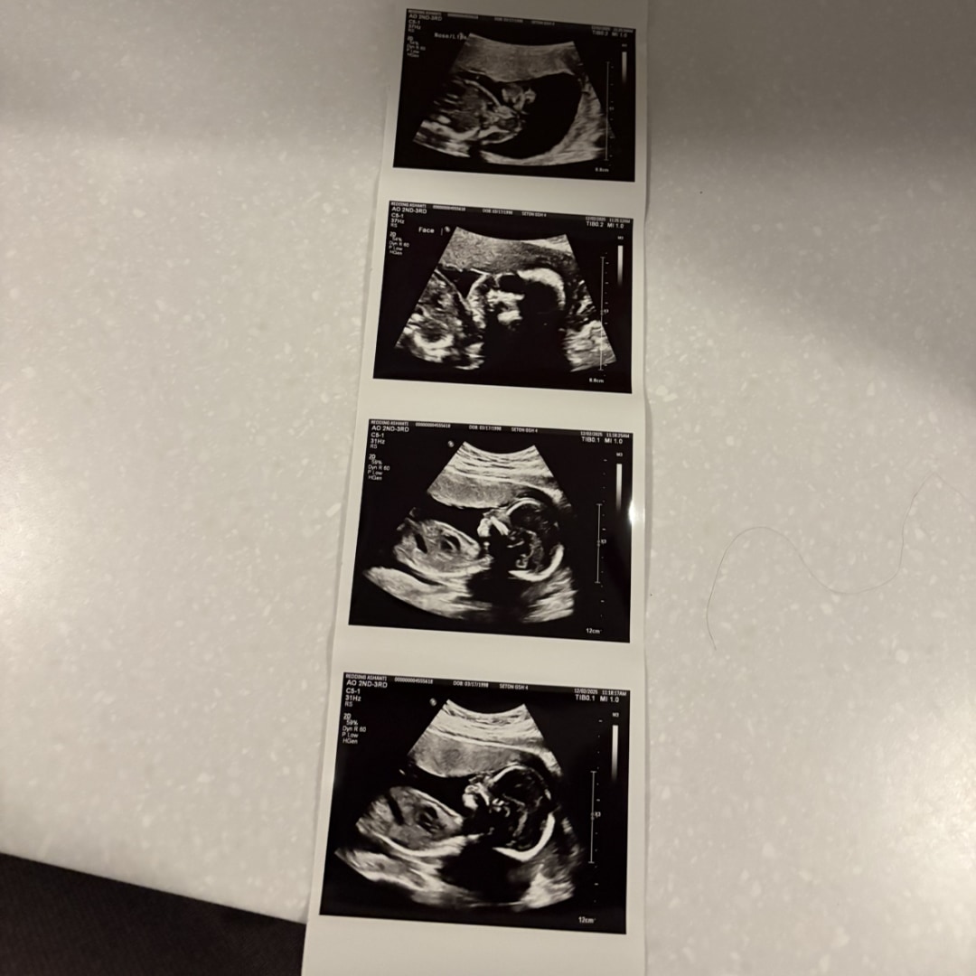 Photo shared by Ashanti for their Babylist baby registry.